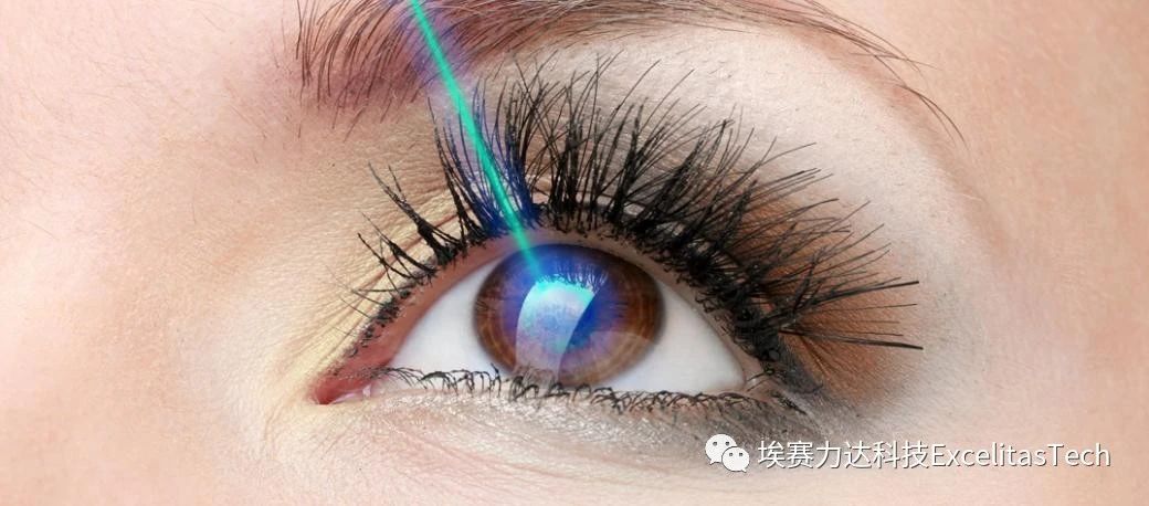 埃赛力达助力高效无创医疗技术:SS-OCT在眼科、心脏病学、皮肤病学和胃肠病的应用 埃赛力达助力高效无创医疗技术:SS-OCT在眼科、心脏病学、皮肤病学和胃肠病的应用