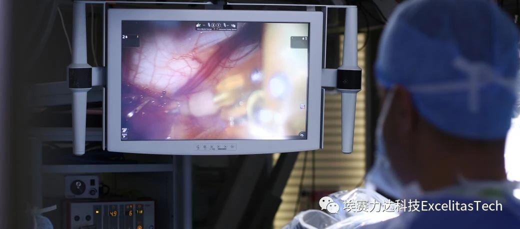 埃赛力达助力高效无创医疗技术:SS-OCT在眼科、心脏病学、皮肤病学和胃肠病的应用 埃赛力达助力高效无创医疗技术:SS-OCT在眼科、心脏病学、皮肤病学和胃肠病的应用