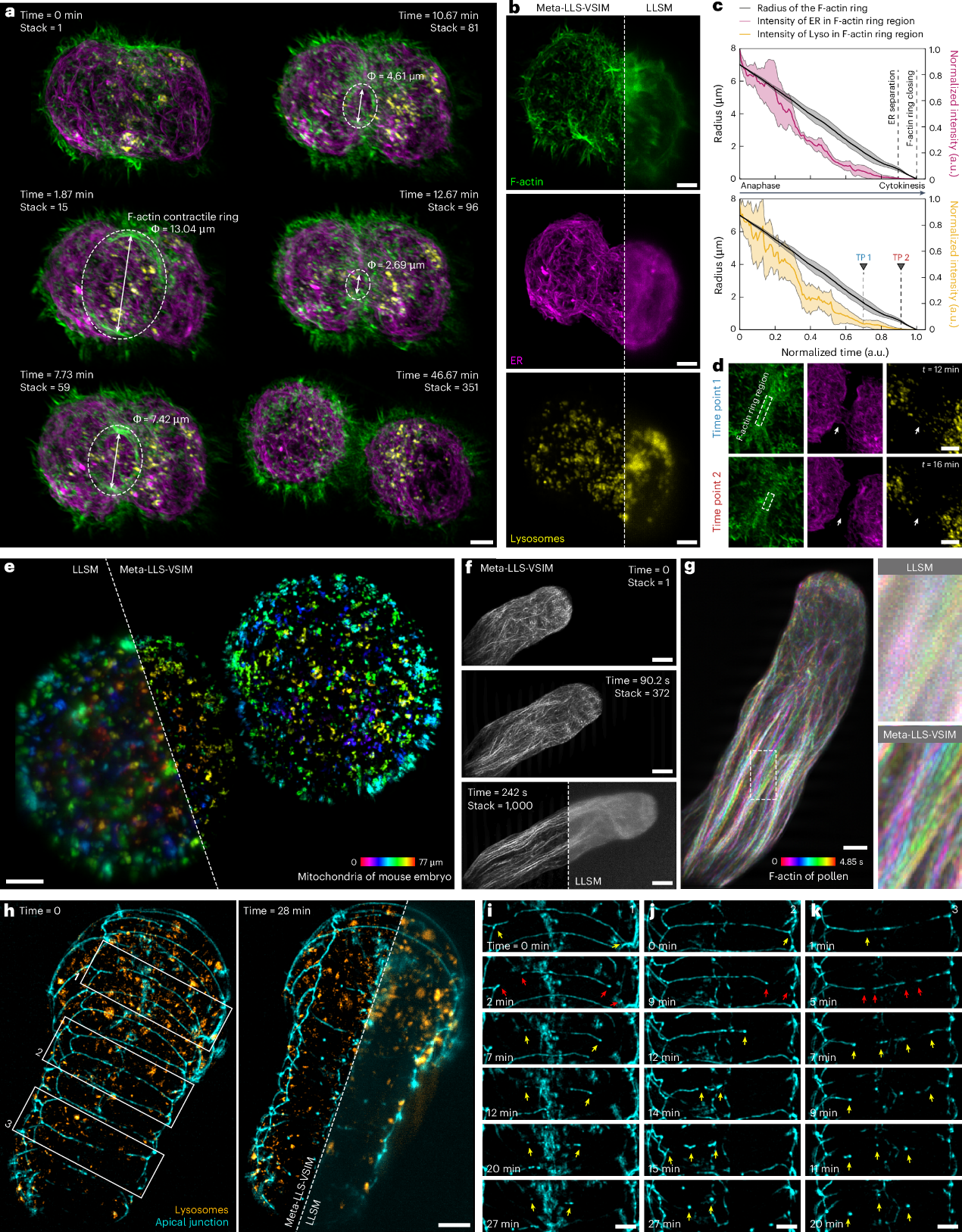 清华大学，最新Nature子刊，超分辨率成像！