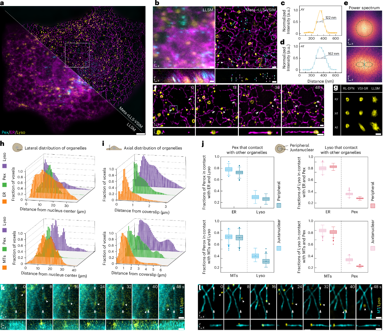清华大学，最新Nature子刊，超分辨率成像！