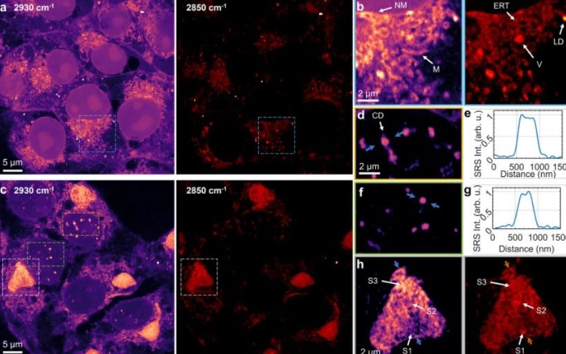 首次实现活体细胞内纳米结构无标记化学成像，科学家用AI开发受激拉曼纳米成像技术，分辨率可达86纳米