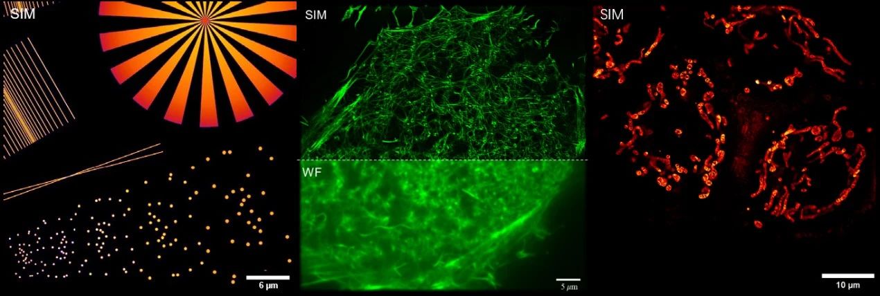 中国科学院宁波材料技术与工程研究所李辉课题组：结构光照明超分辨成像强度保真度的定量评估