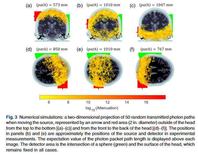 穿越15.5厘米的 “光之旅”:单光子成像如何揭开成人脑深部的神秘面纱 穿越15.5厘米的 “光之旅”:单光子成像如何揭开成人脑深部的神秘面纱