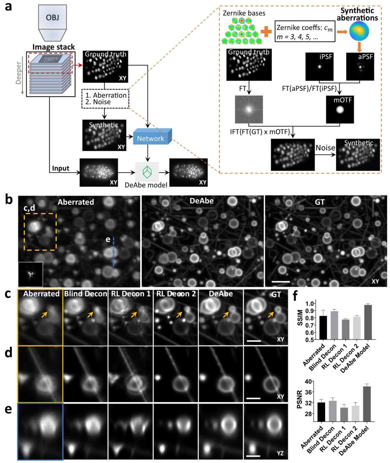 Nature Communications | 深度学习助力消除光学像差难题:速度快成本低分辨率高 Nature Communications | 深度学习助力消除光学像差难题:速度快成本低分辨率高