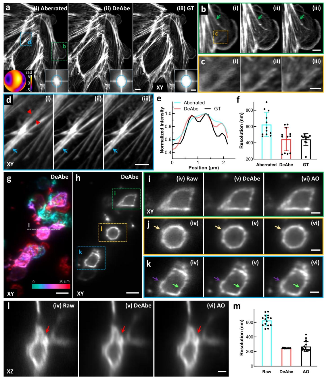 Nature Communications | 深度学习助力消除光学像差难题:速度快成本低分辨率高 Nature Communications | 深度学习助力消除光学像差难题:速度快成本低分辨率高