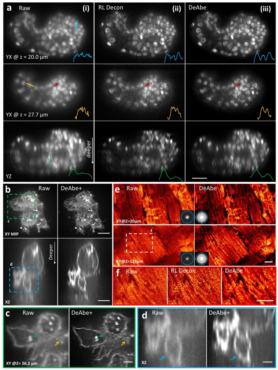 Nature Communications | 深度学习助力消除光学像差难题:速度快成本低分辨率高 Nature Communications | 深度学习助力消除光学像差难题:速度快成本低分辨率高