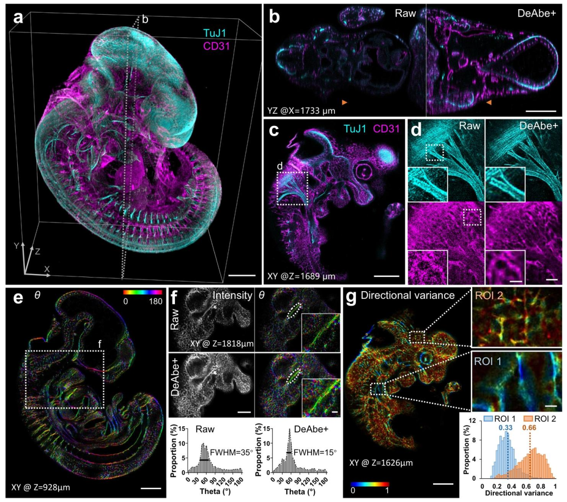 Nature Communications | 深度学习助力消除光学像差难题:速度快成本低分辨率高 Nature Communications | 深度学习助力消除光学像差难题:速度快成本低分辨率高