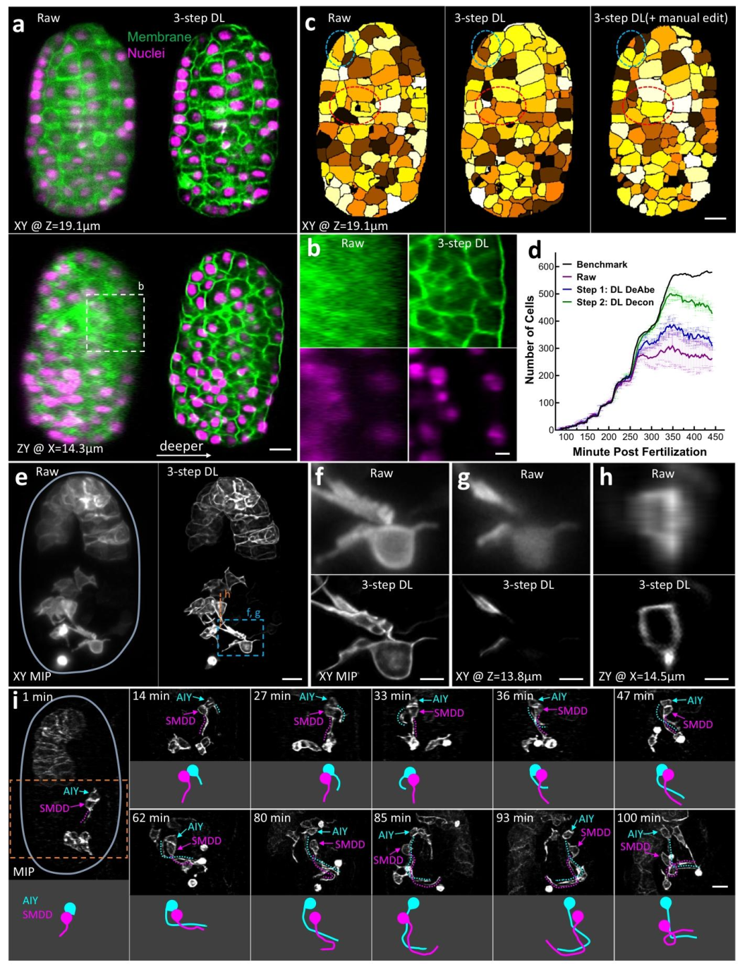 Nature Communications | 深度学习助力消除光学像差难题:速度快成本低分辨率高 Nature Communications | 深度学习助力消除光学像差难题:速度快成本低分辨率高