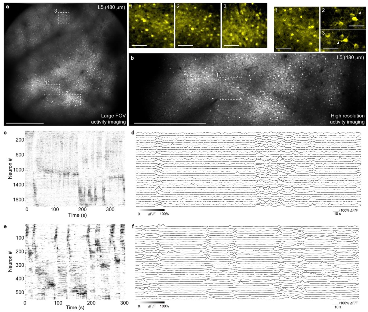 《Nature Methods》:成年斑马鱼全脑级成像的超大视场多光子显微镜 《Nature Methods》:成年斑马鱼全脑级成像的超大视场多光子显微镜