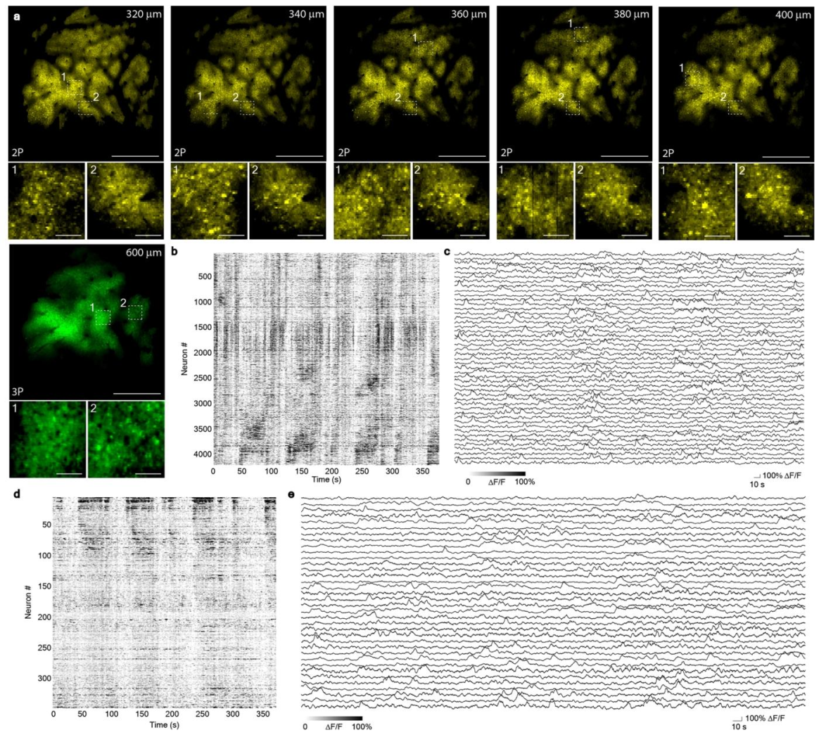 《Nature Methods》:成年斑马鱼全脑级成像的超大视场多光子显微镜 《Nature Methods》:成年斑马鱼全脑级成像的超大视场多光子显微镜