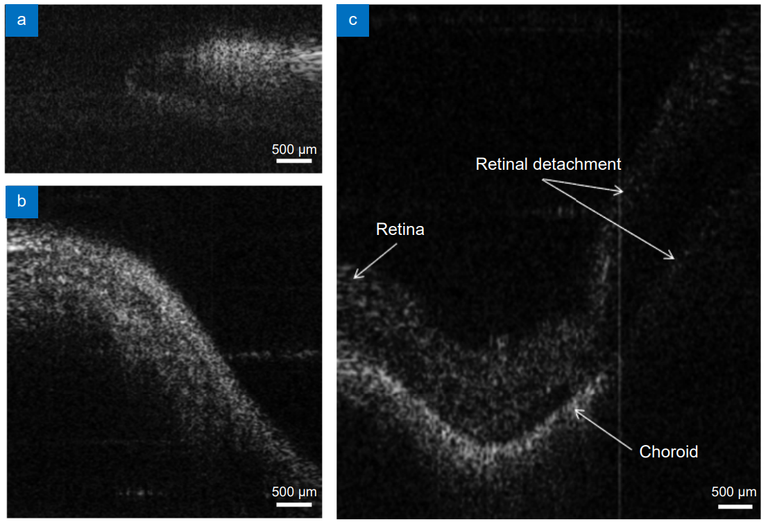 OEE封面 | 大视场内窥OCT助力眼科成像【中国科学院史国华研究员团队】 OEE封面 | 大视场内窥OCT助力眼科成像【中国科学院史国华研究员团队】
