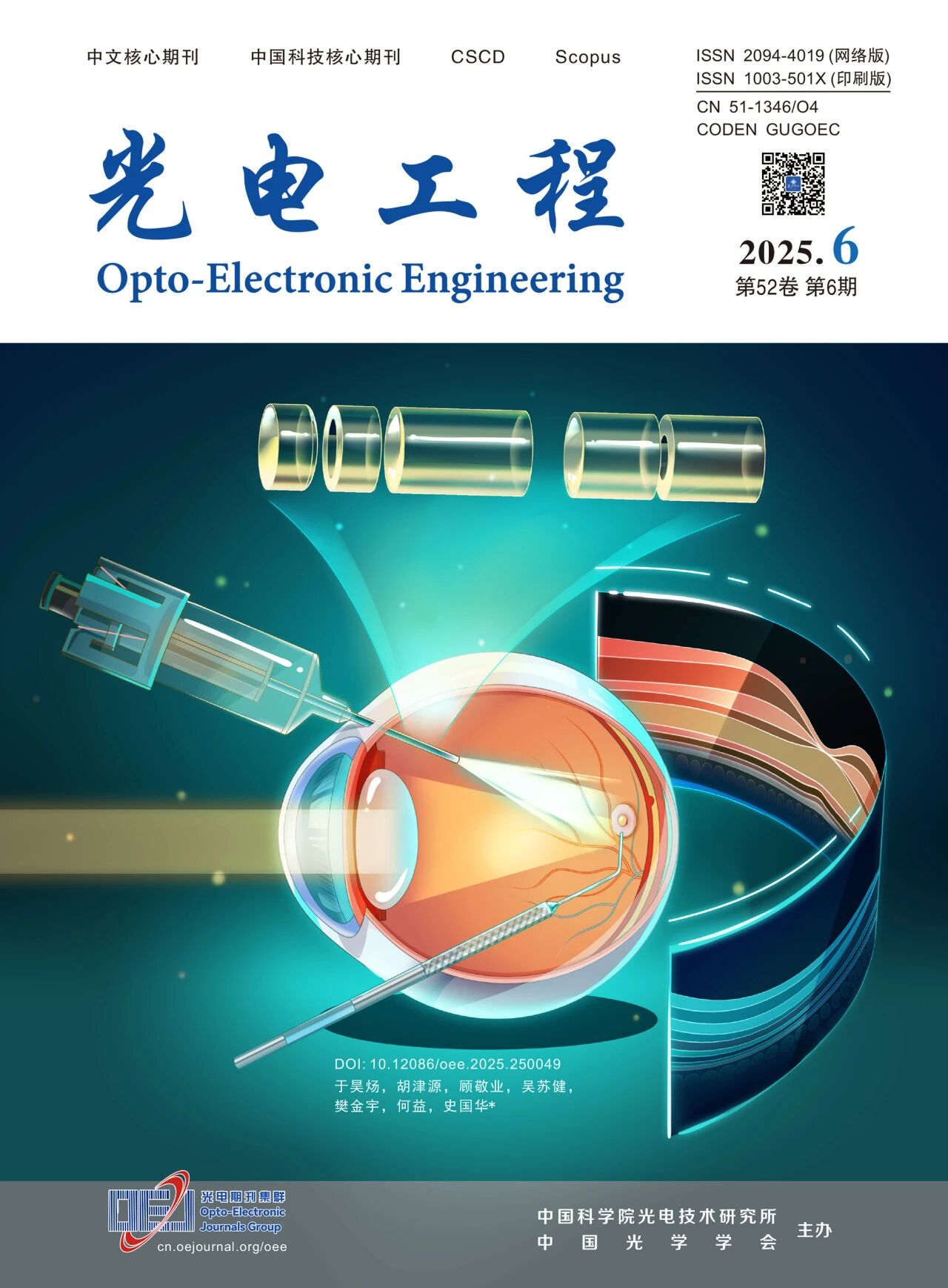 OEE封面 | 大视场内窥OCT助力眼科成像【中国科学院史国华研究员团队】 OEE封面 | 大视场内窥OCT助力眼科成像【中国科学院史国华研究员团队】