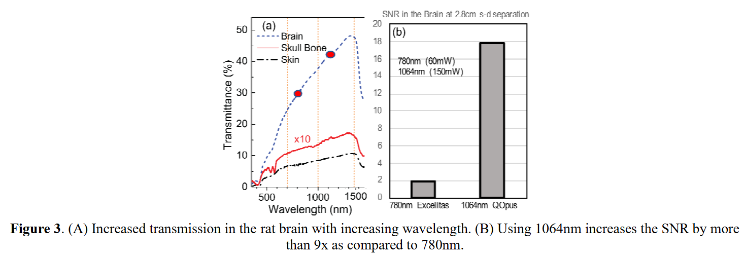 突破脑血流监测瓶颈:从SNSPD到SPAD相机的无创革命 突破脑血流监测瓶颈:从SNSPD到SPAD相机的无创革命