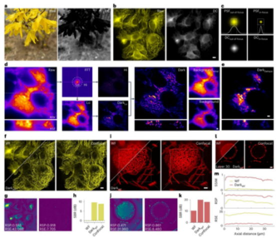 荧光显微镜背景太强怎么办?Nature Methods|北京大学席鹏团队发表高保真背景去除技术Dark sectioning 荧光显微镜背景太强怎么办?Nature Methods|北京大学席鹏团队发表高保真背景去除技术Dark sectioning