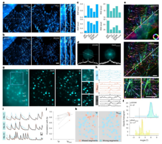 荧光显微镜背景太强怎么办?Nature Methods|北京大学席鹏团队发表高保真背景去除技术Dark sectioning 荧光显微镜背景太强怎么办?Nature Methods|北京大学席鹏团队发表高保真背景去除技术Dark sectioning