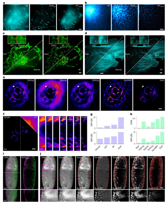荧光显微镜背景太强怎么办?Nature Methods|北京大学席鹏团队发表高保真背景去除技术Dark sectioning 荧光显微镜背景太强怎么办?Nature Methods|北京大学席鹏团队发表高保真背景去除技术Dark sectioning