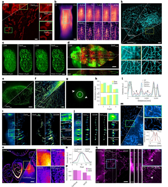 荧光显微镜背景太强怎么办?Nature Methods|北京大学席鹏团队发表高保真背景去除技术Dark sectioning 荧光显微镜背景太强怎么办?Nature Methods|北京大学席鹏团队发表高保真背景去除技术Dark sectioning
