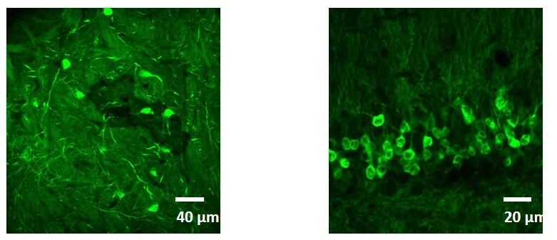 950nm飞秒激光器,双光子成像的理想光源? | OE NEWS 950nm飞秒激光器,双光子成像的理想光源? | OE NEWS