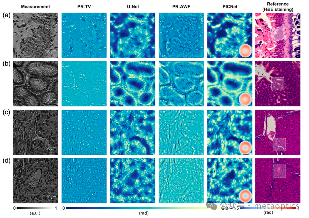 Advanced Photonics - 通过物理驱动深度学习实现自适应像差校正的定量相位显微技术