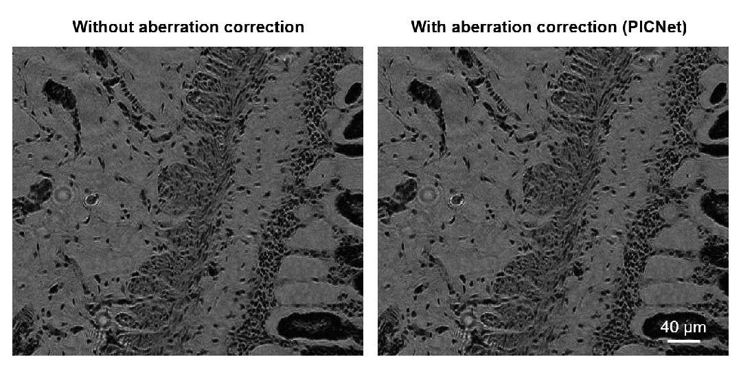 Adv. Photon.丨清华大学精密仪器系研究团队实现像差自校准的智能显微成像
