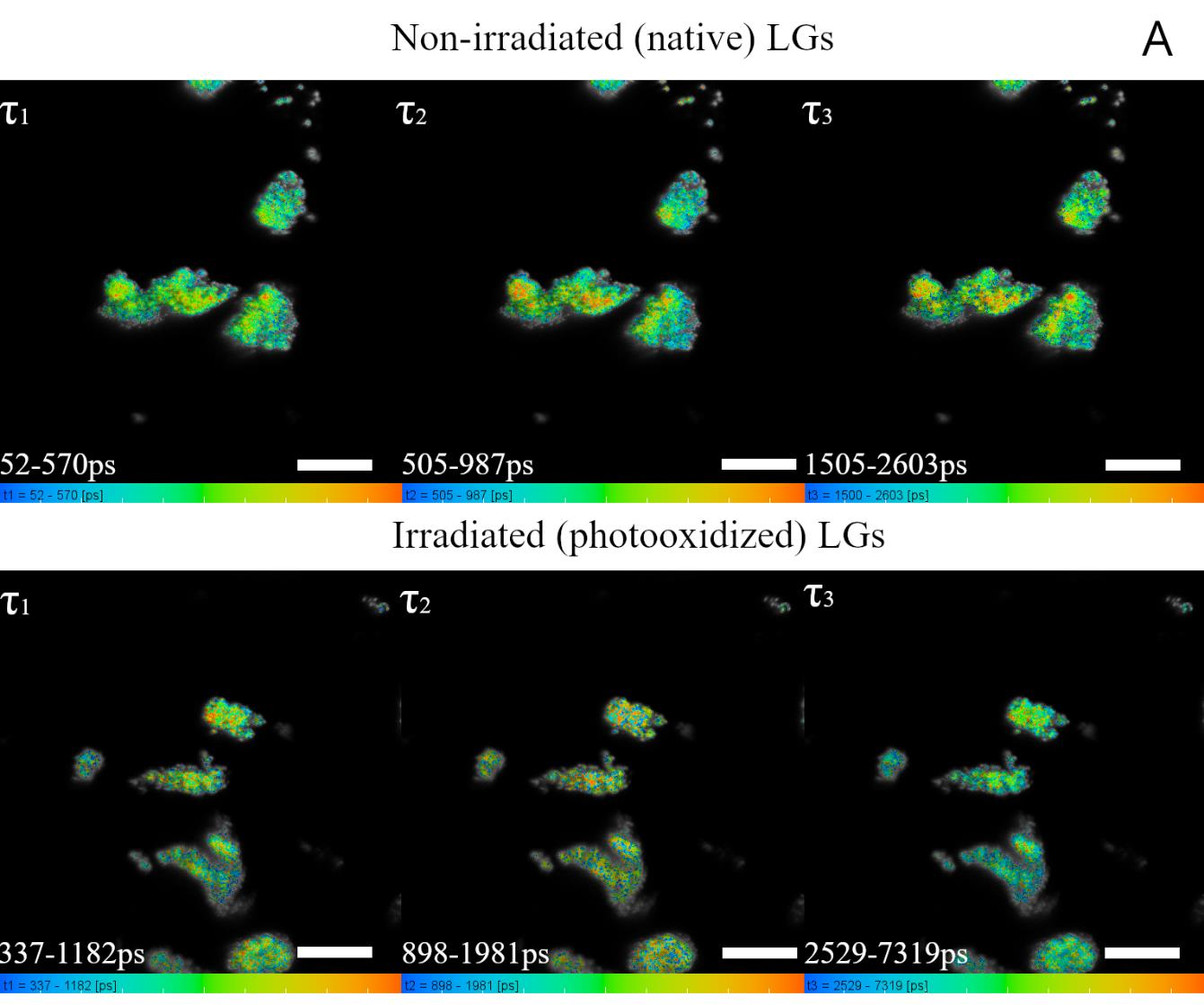 超导单光子探测器SNSPD助力解析视网膜脂褐素病理特性