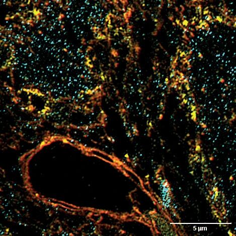 基于 pco.edge 10 bi 相机实现的大视场光学切片与超分辨率 SIM 成像 （上）
