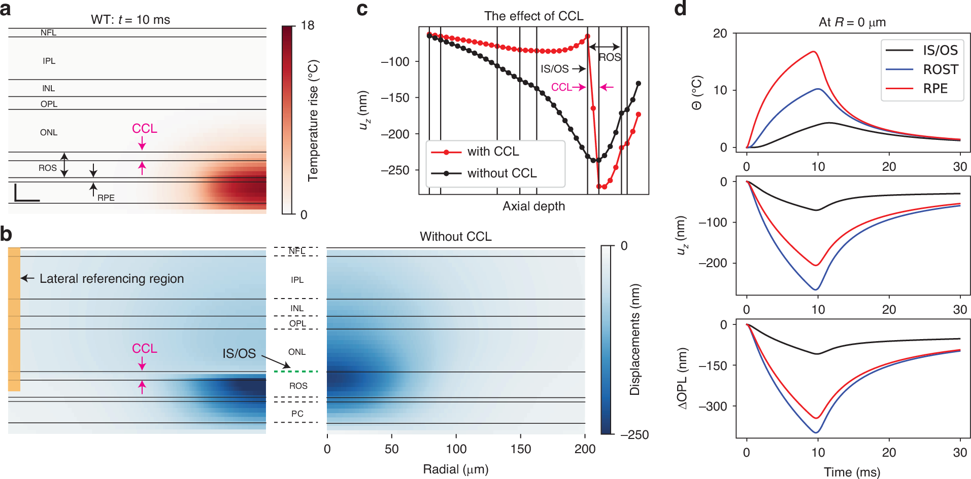 Light | 基于相位敏感光学相干断层扫描的活体视网膜热变形测量