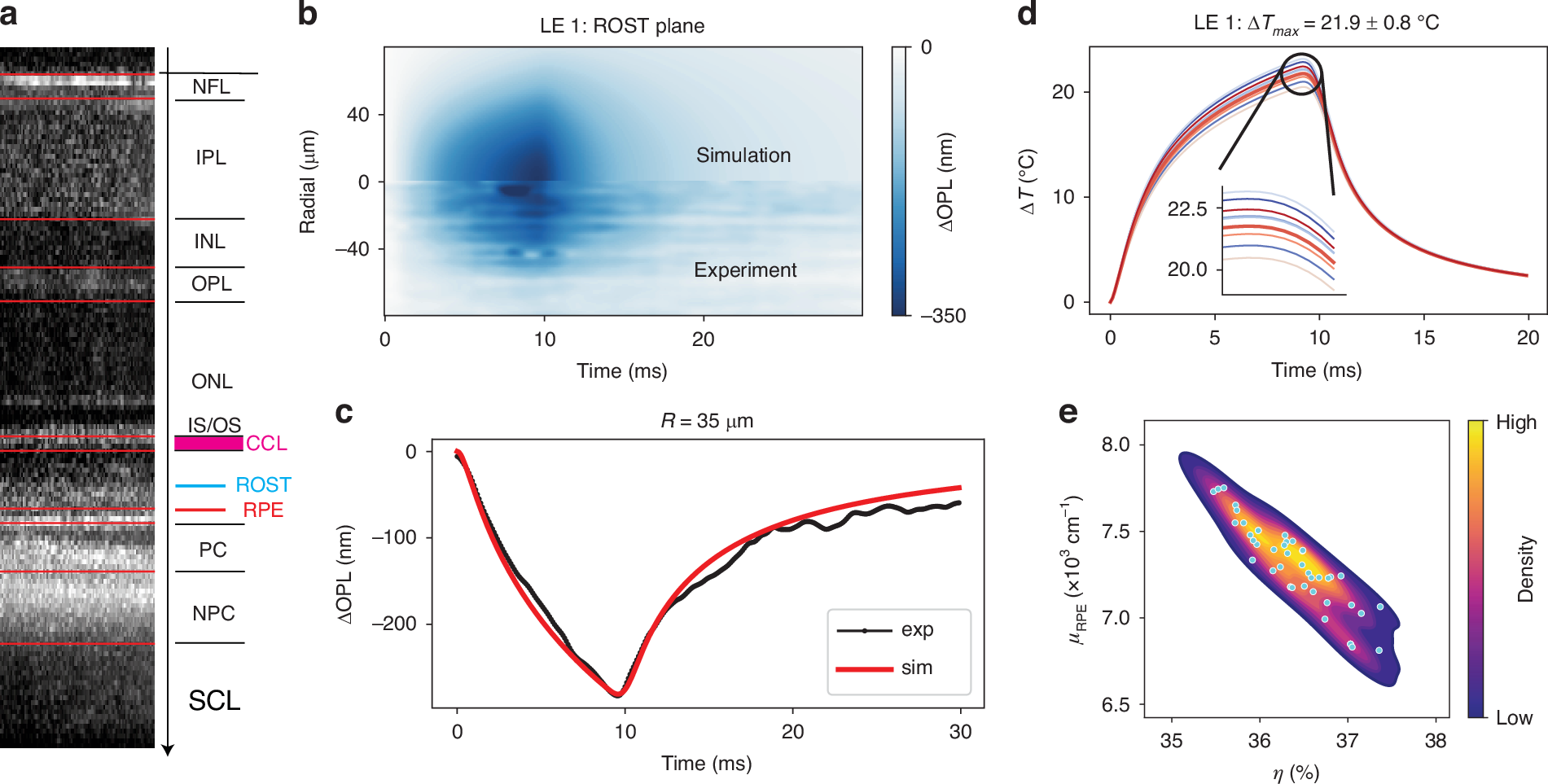 Light | 基于相位敏感光学相干断层扫描的活体视网膜热变形测量