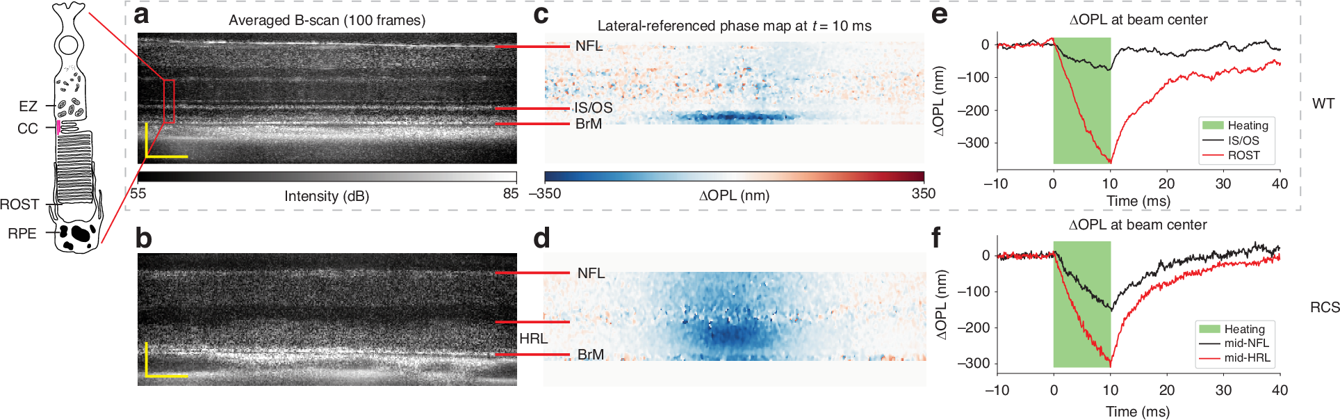 Light | 基于相位敏感光学相干断层扫描的活体视网膜热变形测量