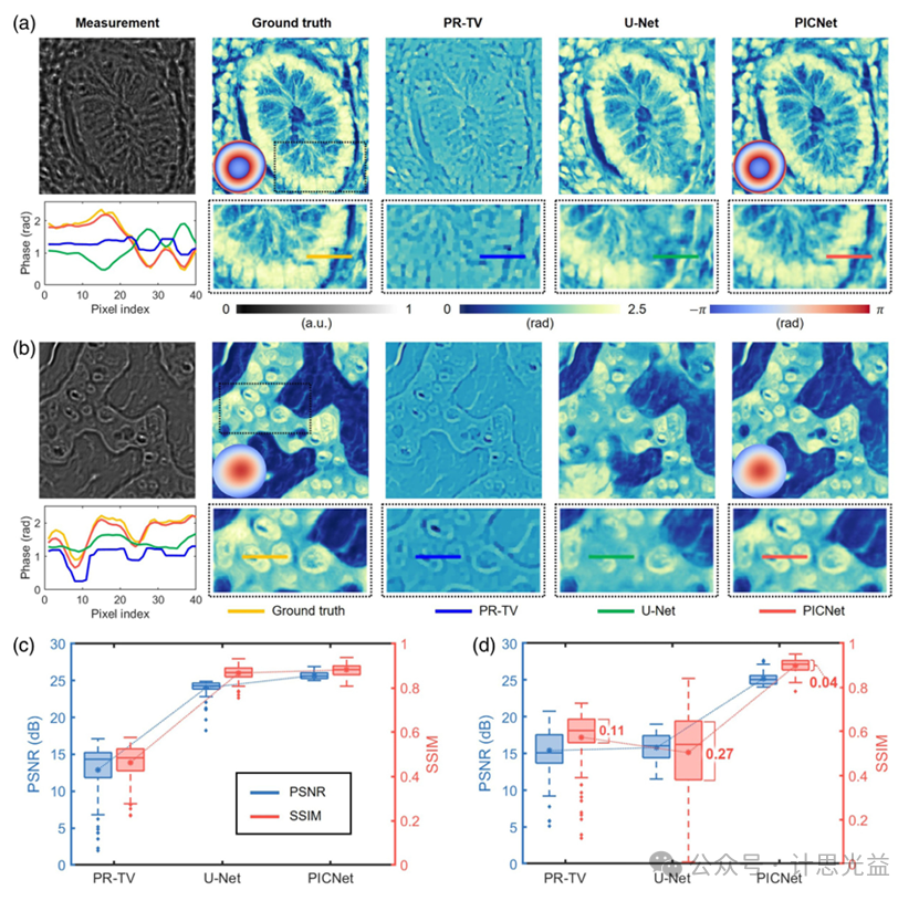 [文献速递No.571]基于物理先验信息的自适应相差校正定量相位成像
