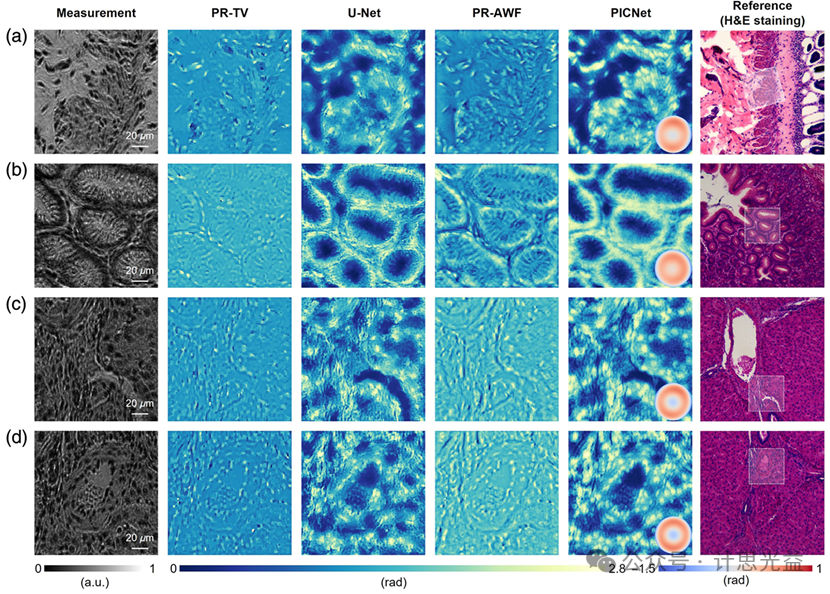 [文献速递No.571]基于物理先验信息的自适应相差校正定量相位成像
