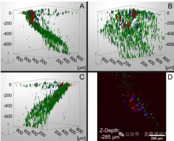 亚利桑那大学突破：五光子显微镜，让癌细胞无处遁形！