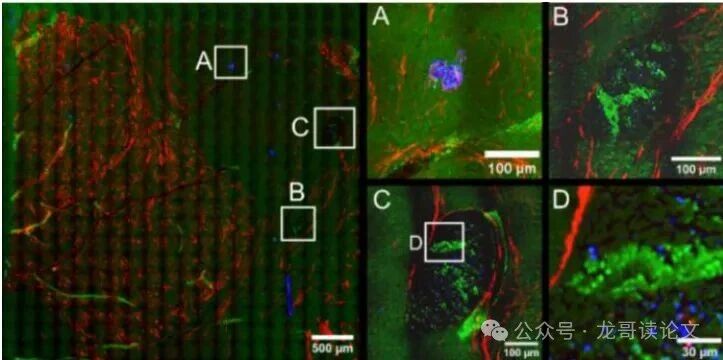 亚利桑那大学突破：五光子显微镜，让癌细胞无处遁形！