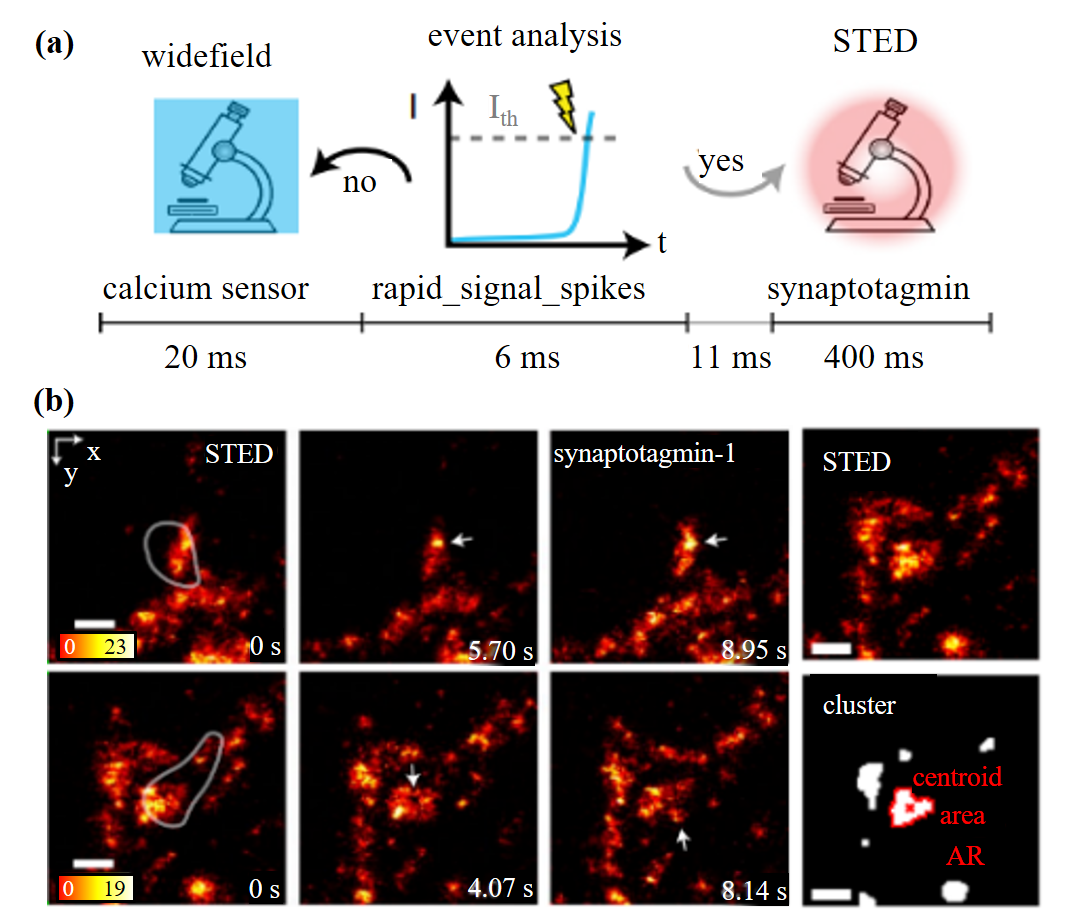 专题亮点 | 事件驱动显微成像：生物活体成像新前沿
