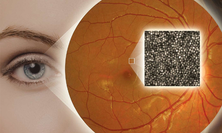 自适应光学技术和高分辨率视网膜成像