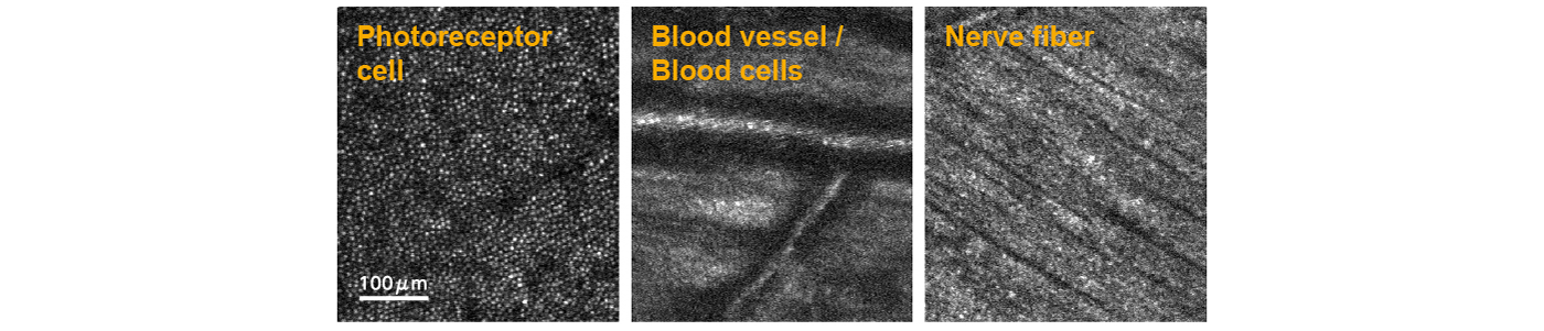 自适应光学技术和高分辨率视网膜成像